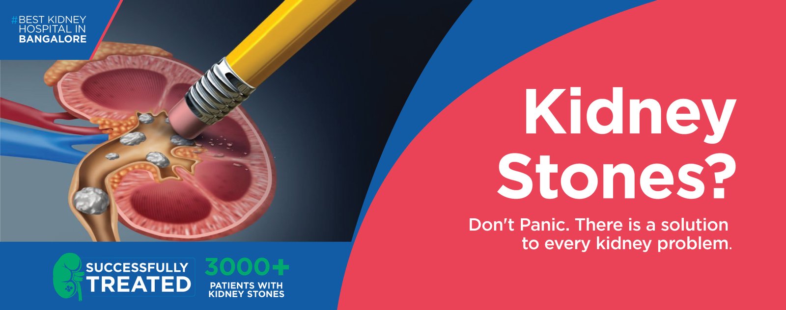 bangalore kidney stone hospital