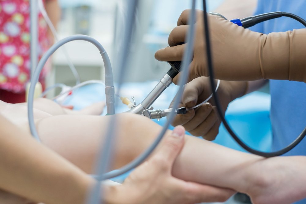 kidney transplant cost in bangalore