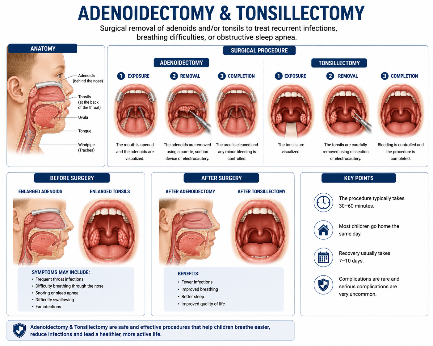 Tonsillectomy adenoidectomy ENT surgery Regal Hospital Bangalore