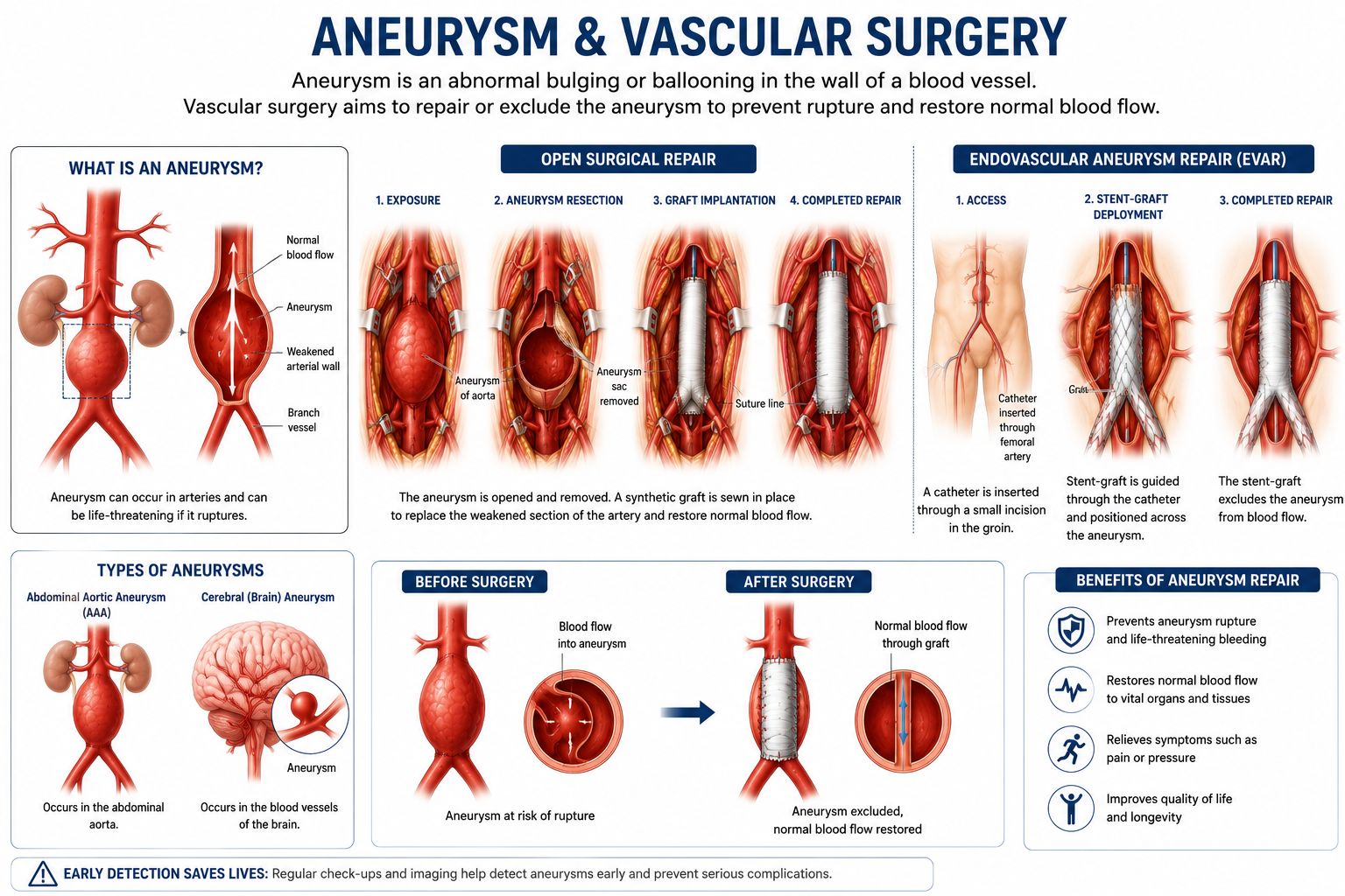 Brain aneurysm clipping vascular neurosurgery Regal Hospital Bangalore