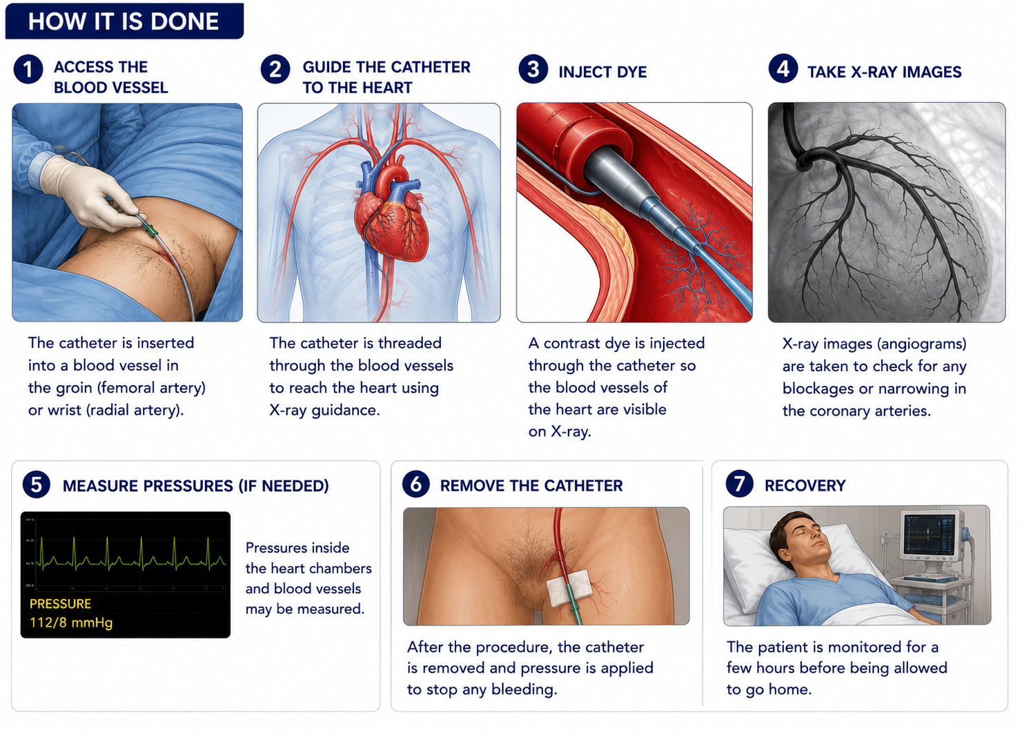 Cardiology Cardiac catheterization diagnostic test Regal Hospital Bangalore