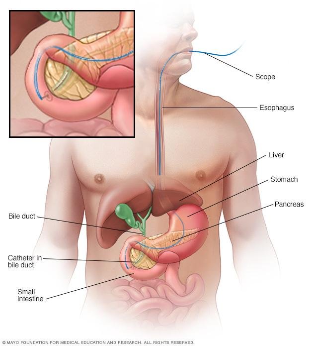 Gastrointestinal surgery Upper endoscopy ERCP biliary stone removal Regal Hospital North Bangalore
